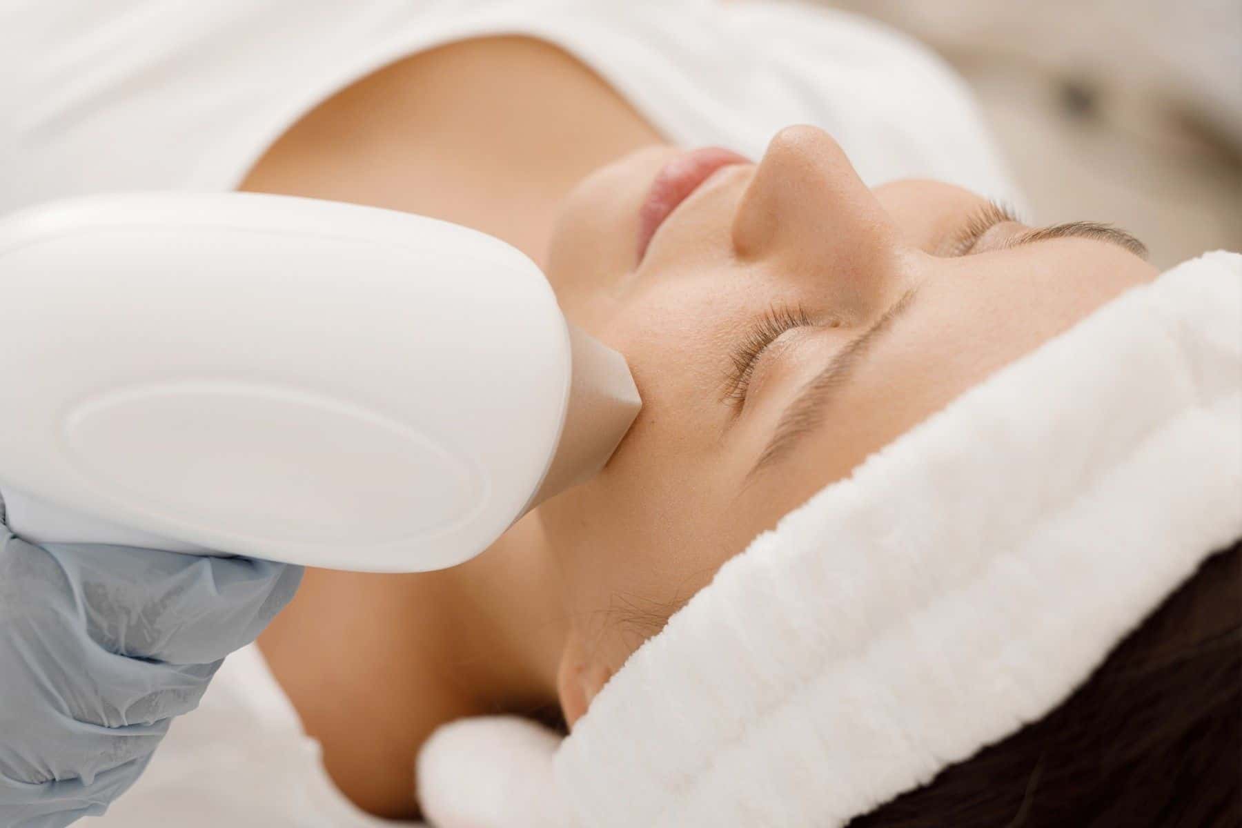 Cosmetic IPL Therapy