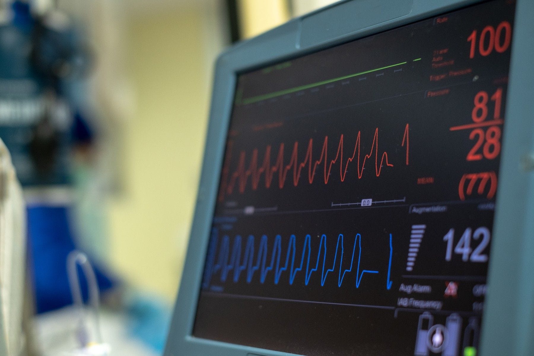 Cardiac monitor