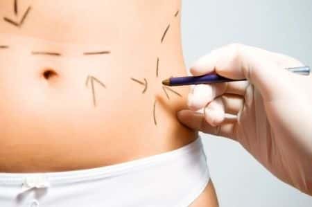 Cosmetic Surgery Leads to Permanent Nerve Damage