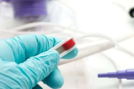 Patient Discharged From Hospital With Dislodged Feeding Tube