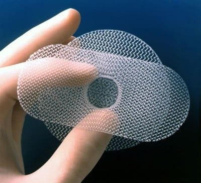 Transvaginal Mesh