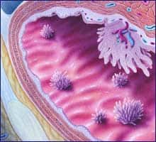 Fatal Cancer Goes Untreated Despite Suspicious CT Scan