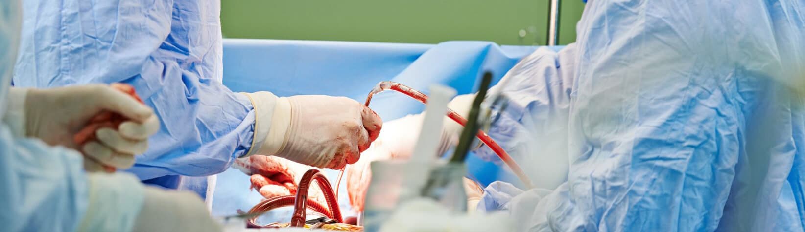 Vascular Surgery Expert Witness