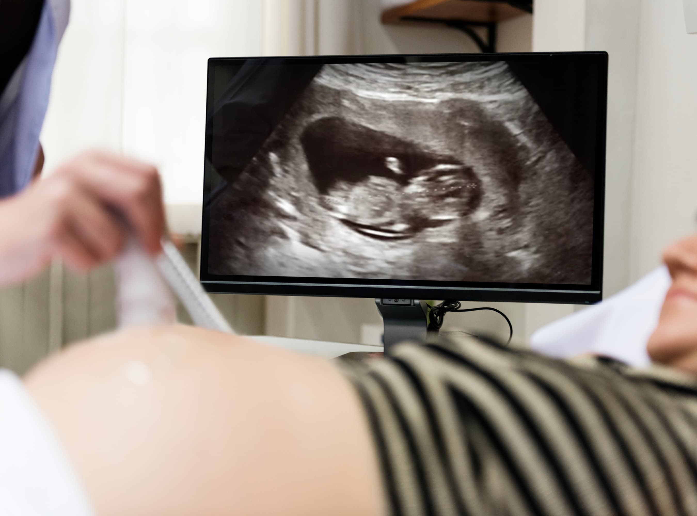 First Zofran Bellwether Delayed Indefinitely Due To COVID-19