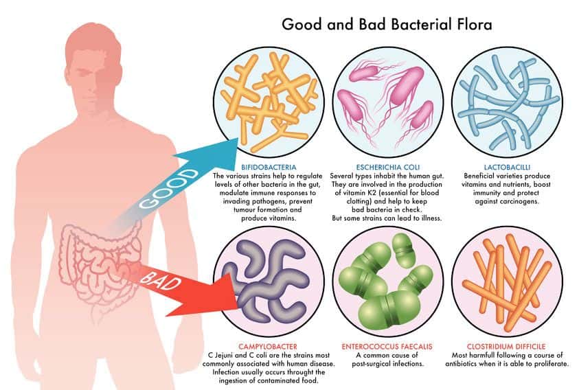 Misdiagnosis of C. Difficile and Sepsis Results in Patients Death