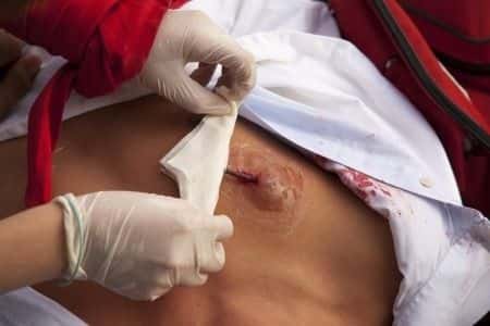 Patient Develops Necrotizing Infection in Hospital