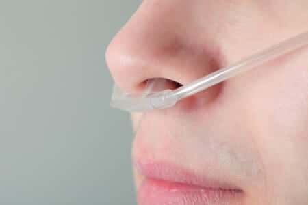 Missed Diagnosis of Nasal Mass Ends in Metastatic Disease