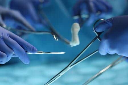 Expert in Myomectomy Comments on Cyst Removal