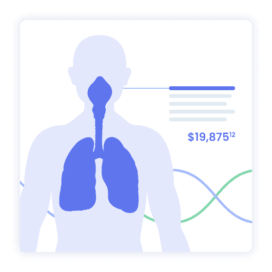 Earnings loss evaluation