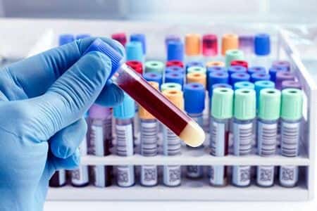 Toxicology Expert Evaluates Role of Opioid Pain Medication in Suspected Overdose