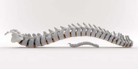 Chiropractic Adjustment Causes Arterial Injury and Stroke