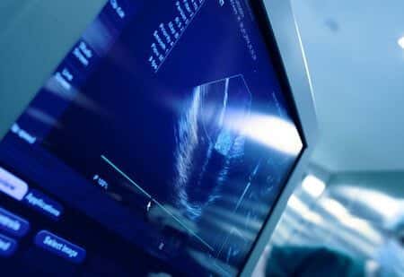 Vascular Surgery Patient Experiences Severe Stroke During Procedure