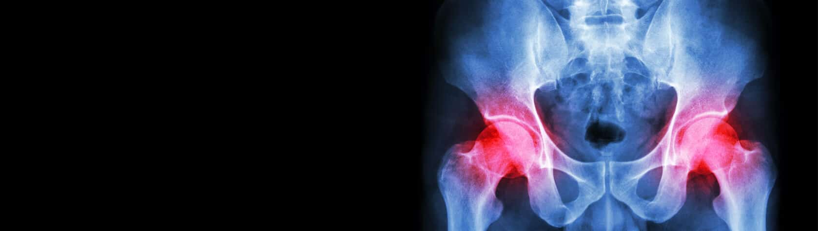 Orthopedic Surgery Expert Witness